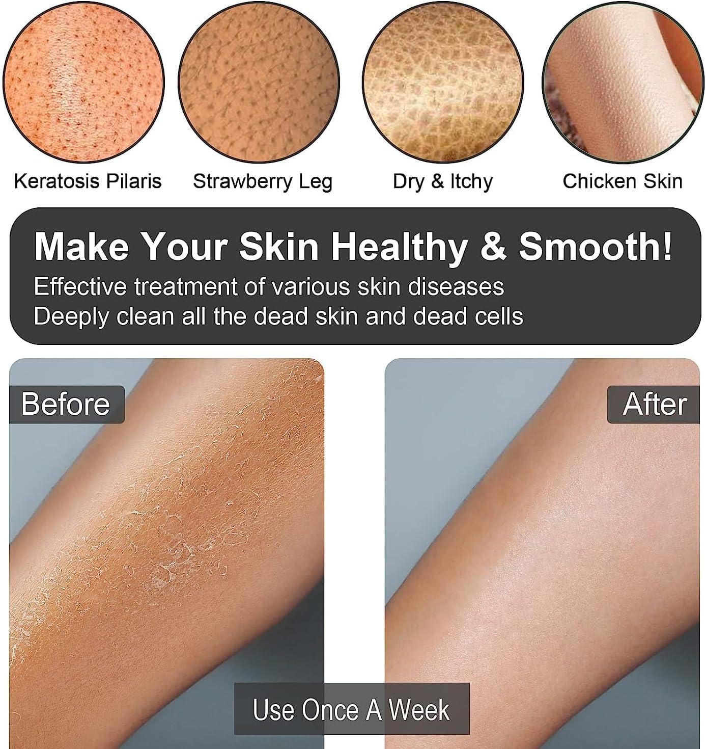 Yiclick 12Pcs Heavy Exfoliating Gloves, Body Scrub Glove For Shower Bath, Body Scrub Exfoliator, Exfoliating Body Scrubber for Bath Shower Exfoliation, Exfoliate Sponge Loofah Washcloth Mitt Men Women